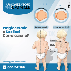 Armonizzatore Craniale - Caschetto Plagiocefalia