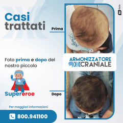 Armonizzatore Craniale - Caschetto Plagiocefalia