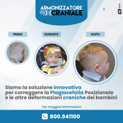 Armonizzatore Craniale - Caschetto Plagiocefalia
